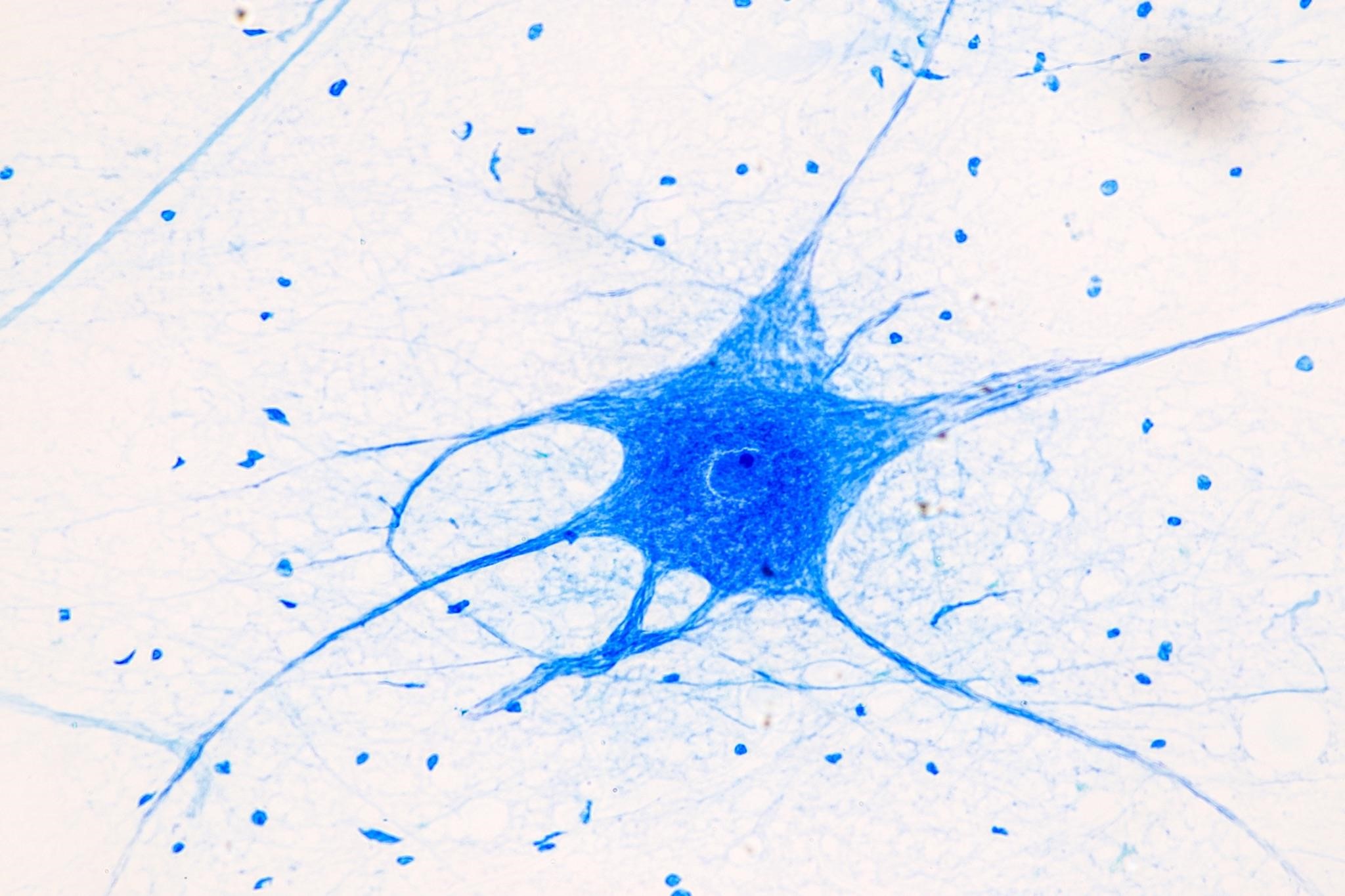 neuron